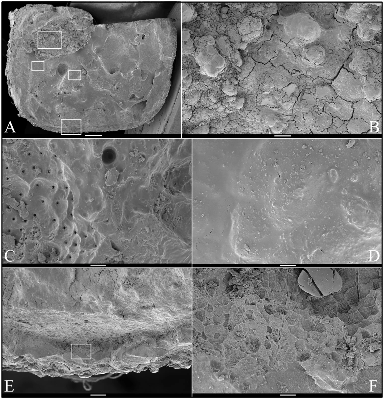 Scanning Electron Micrographs (SEMs) of molar (#18) occlusal surface.