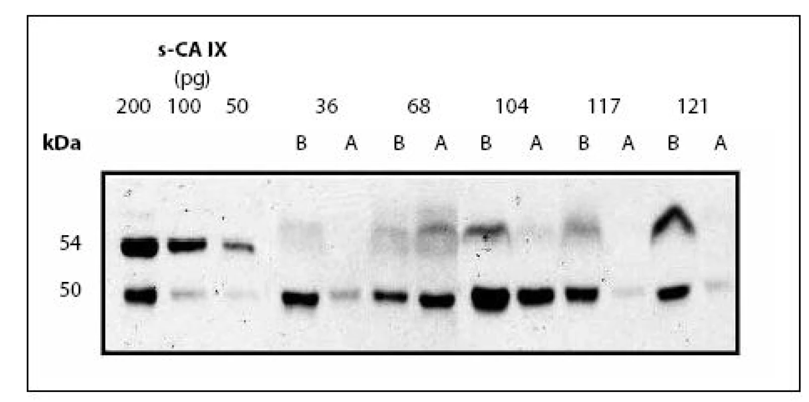 s-CA IX v séru nemocných před a po nefrektomii
Fig. 3. s-CA IX in the serum of RCC patients before and after nephrectomy