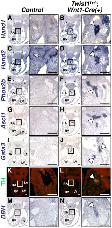 Ectopic neurons in <i>Twist1</i>;<i>Wnt1-Cre</i> CKO APCs express sympathetic neuron markers.