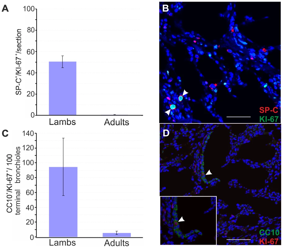 Number of proliferating SP-C<sup>+</sup> and CC10<sup>+</sup> cells in healthy lambs and adult sheep.