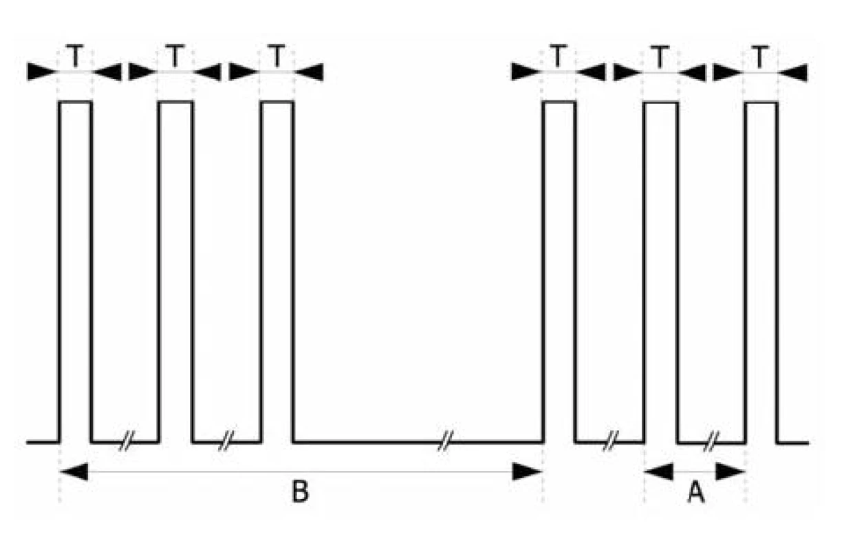 Double burst stimulation (DBS)
T = 0,2 ms, A = 20 ms, B = 750 ms