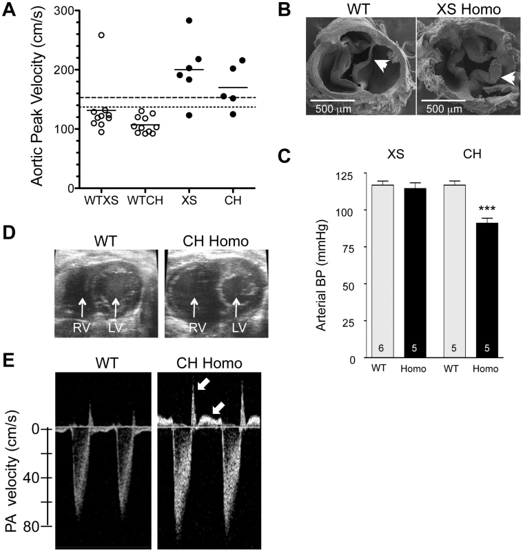 Cardiovascular changes in adult homozygous (homo) gene deletion mutants.