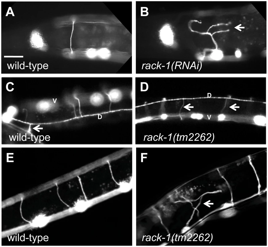 RACK-1 is required for VD/DD motor axon pathfinding.