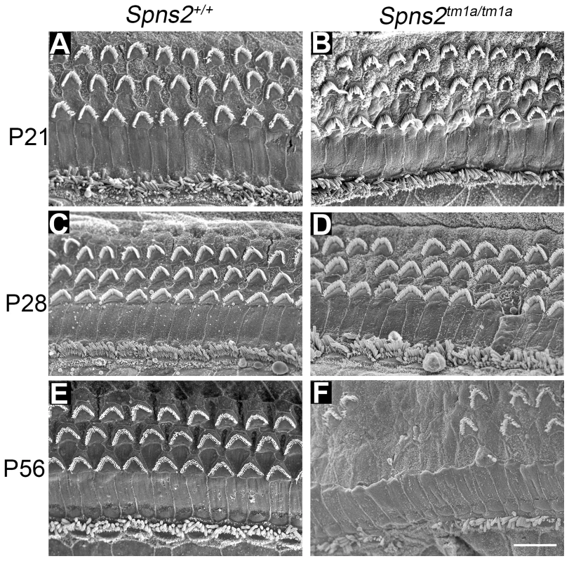 Progressive deterioration of hair cells shown by scanning electron microscopy.
