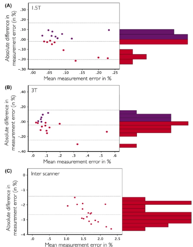 Bland–Altman plots of the comparison MSmetrix versus SIENA on the same datasets for the 1.5T within scanner (A), 3T within scanner (B), and 1.5T versus 3T between scanner (C) comparisons. On the Y-axis of all plots, the difference of the absolute value of the measurement errors is calculated as ‘MSmetrix – SIENA’, on the X-axis of all plots the mean of MSmetrix and SIENA is displayed. Purple dots were used when ‘MSmetrix – SIENA’ is positive, red dots when this difference is negative. In addition, the histogram of the ‘MSmetrix – SIENA’ difference is shown on the right of each Bland–Altman plot.