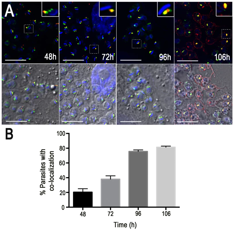 Co-localization of GFP-TcRab11 and TcTS during amastigote differentiation in human foreskin fibroblasts.