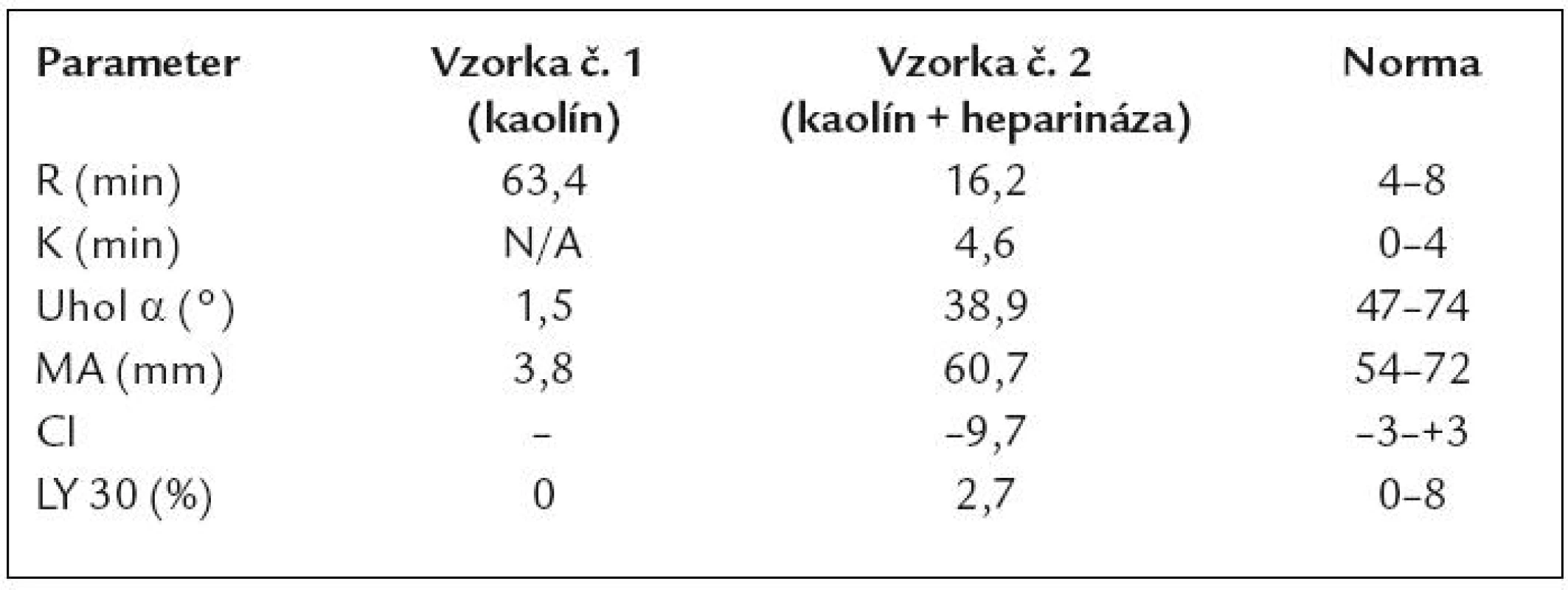 TEG vyšetrenie u sledovaného pacienta s Heart Mate II.