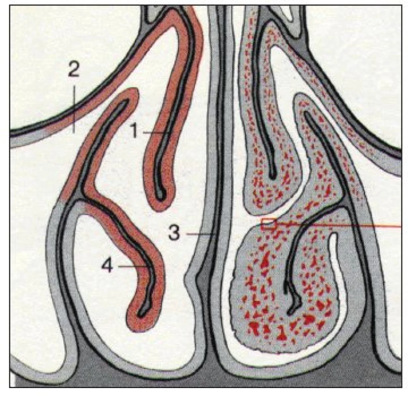 Průřez nosními dutinami ve frontální rovině (podle Beckera).<br>1 – střední skořepa, 2 – vyvod čelistní dutiny, 3 – nosní přepážka, 4 – dolní skořepa, vlevo jsou cévy rozšířené – nazální cyklus.