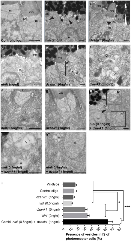 <i>dzank1</i> and <i>ninl</i> knockdown leads to accumulation of vesicles and vacuoles in zebrafish photoreceptors.