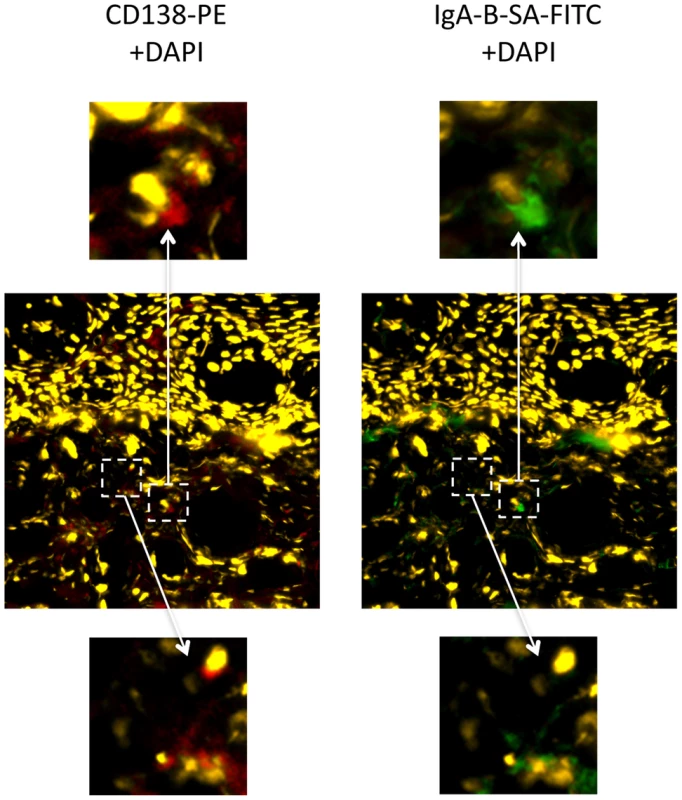 IgA+CD138+ cells in the foreskin of an HIV-uninfected Ugandan man.
