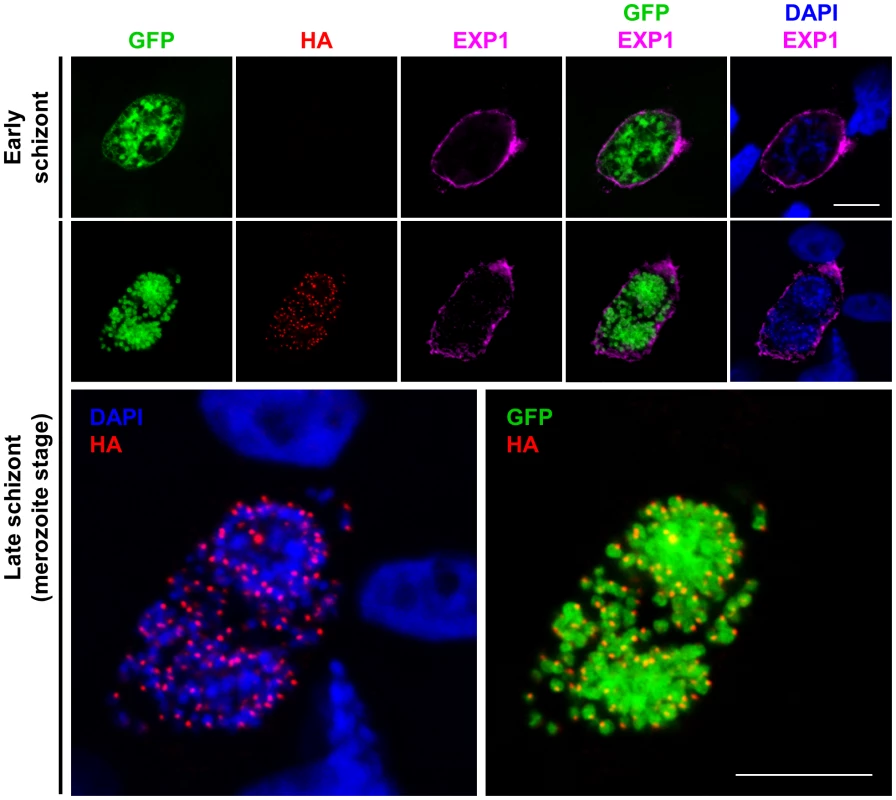 PbSUB1 is expressed in exoneme-like subcellular organelles in mature liver stage schizonts.