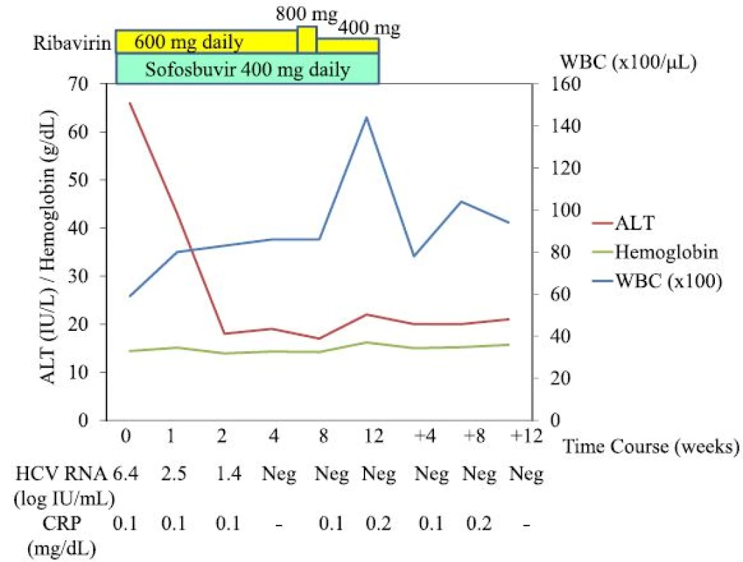 Clinical course of the patient. <i>ALT</i> alanine transaminase, <i>WBC</i> white blood cells, <i>w</i> weeks, <i>Neg</i> negative