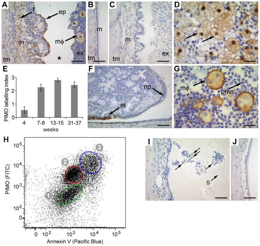 The inflamed middle ear of the <i>Jbo/+</i> and <i>Jf/+</i> mice is hypoxic.