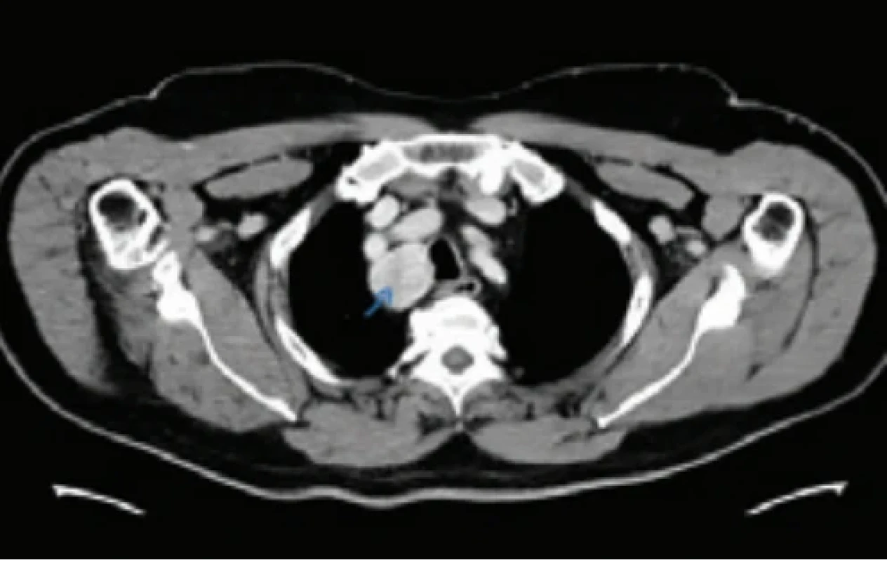  / Fig. 3.