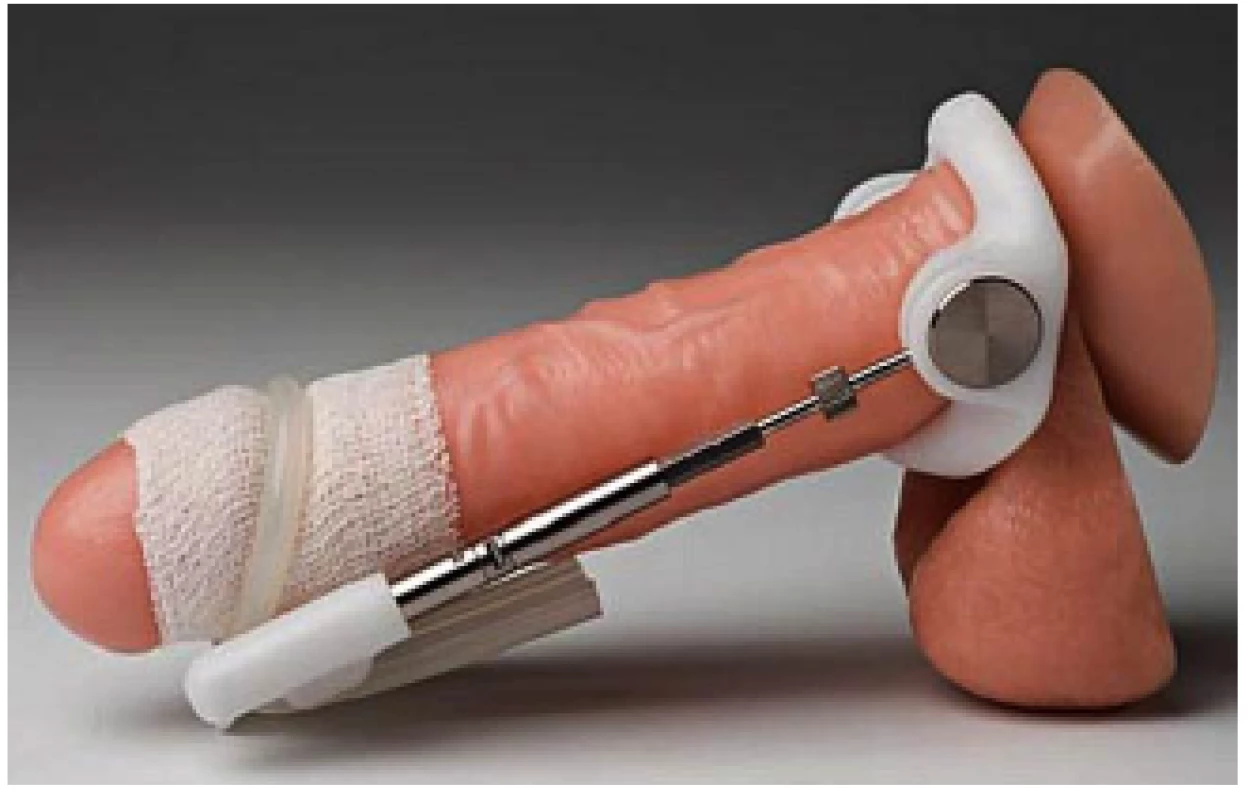 Trakční aparát
Fig. 11 Traction device