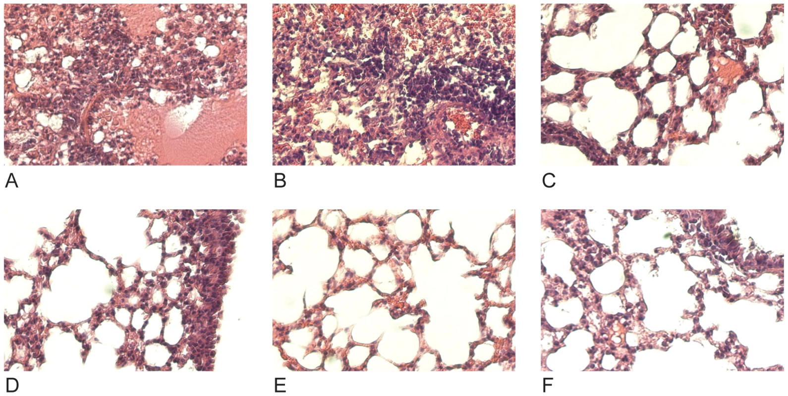 Treatment with anti-H3 mAbs diminishes lung damage associated with viral pneumonia caused by HK68/PR8 reassortant virus.