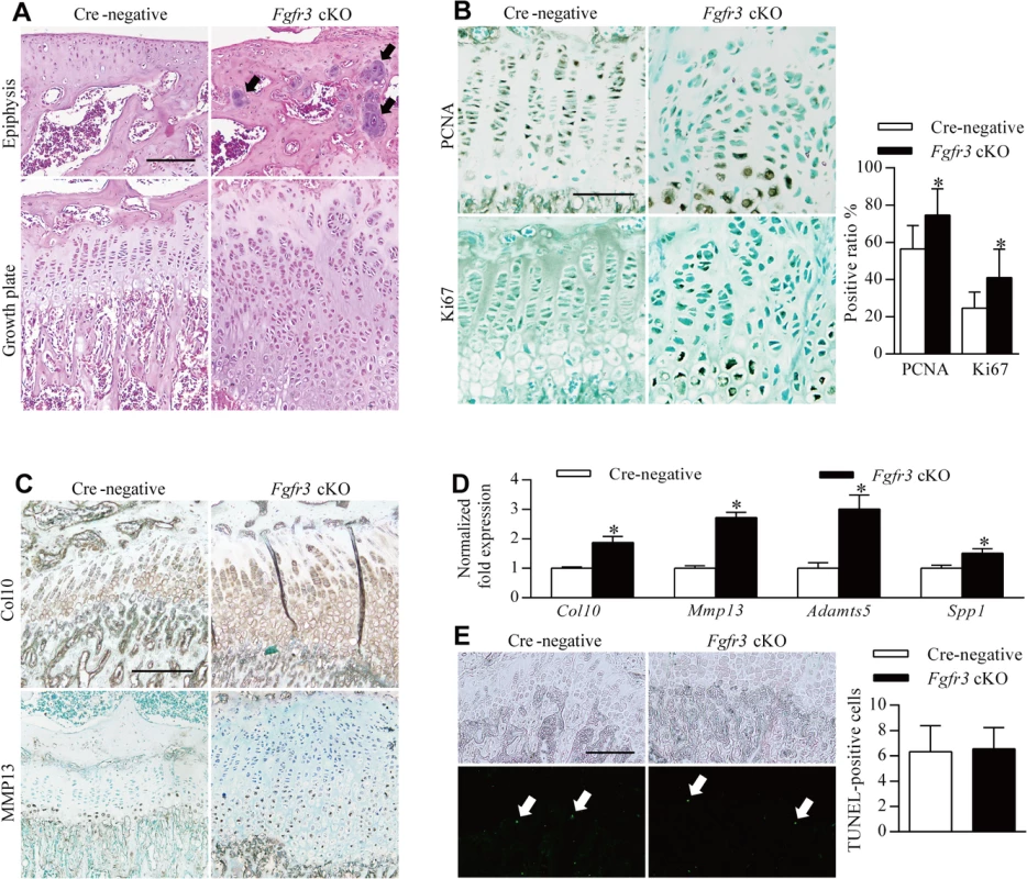 Impaired homeostasis of growth plate chondrocytes in <i>Fgfr3</i> cKO mice.