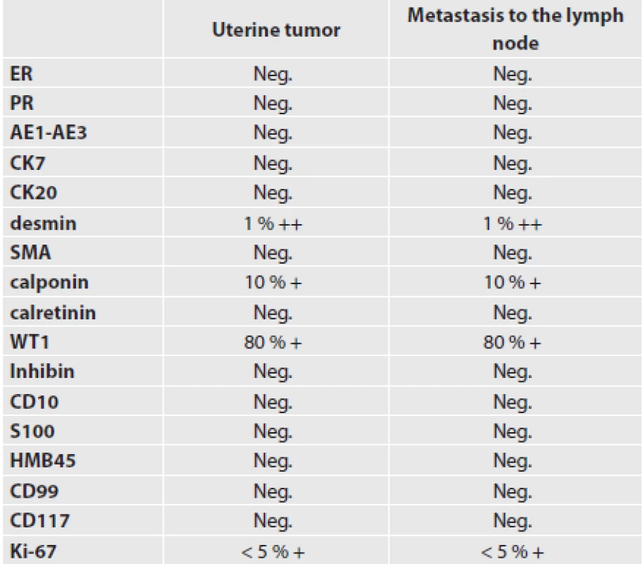 Antibodies used and immunohistological results