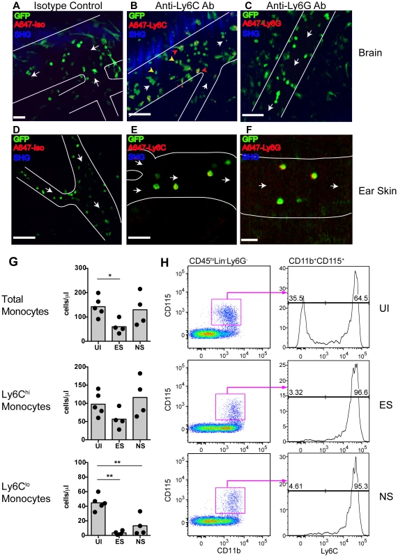 Endothelium-interacting GFP<sup>+</sup> leukocytes in the brain microvasculature are monocytes.