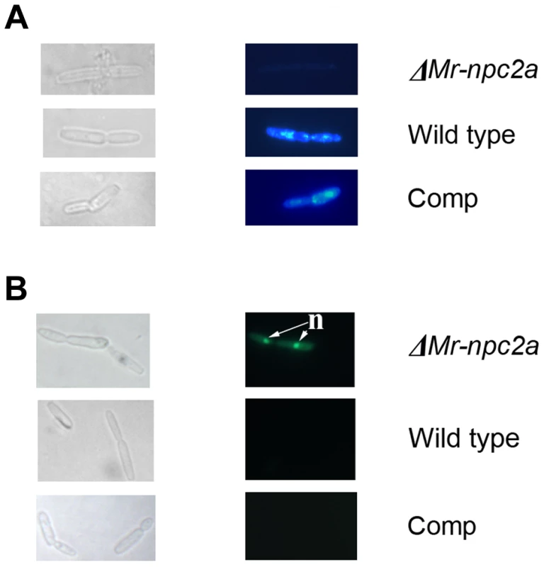 Filipin and sytox green staining of <i>M. robertsii</i> hyphal bodies collected from the hemolymph of living insects.