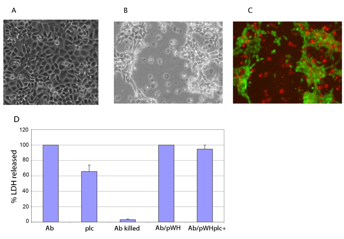 Cell damage associated with <i>A. baumannii</i> infection.