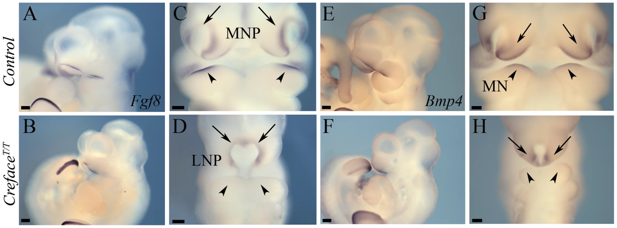 <i>Creface<sup>T/T</sup></i> embryos exhibit frontonasal and pharyngeal epithelial patterning defects.