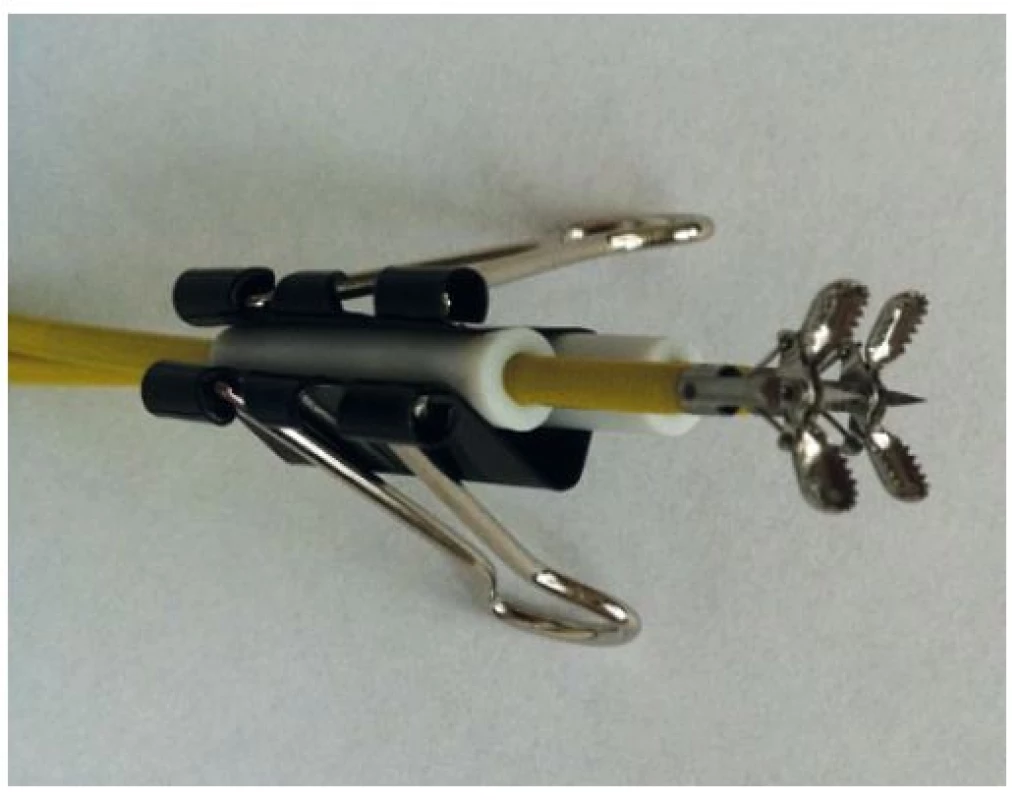 Porovnání bioptických kleští: vpravo large capacity kleště (průměr 2,4 mm); vlevo jumbo kleště (průměr 2,8 mm).
Fig. 1. Comparison of biopsy forceps: large capacity forceps (2.4 mm in diameter) on the right; jumbo forceps (2.8 mm in diameter) on the left.
