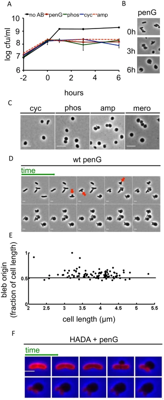 Inhibition of cell-wall synthesis in <i>V</i>. <i>cholerae</i> leads to sphere formation.