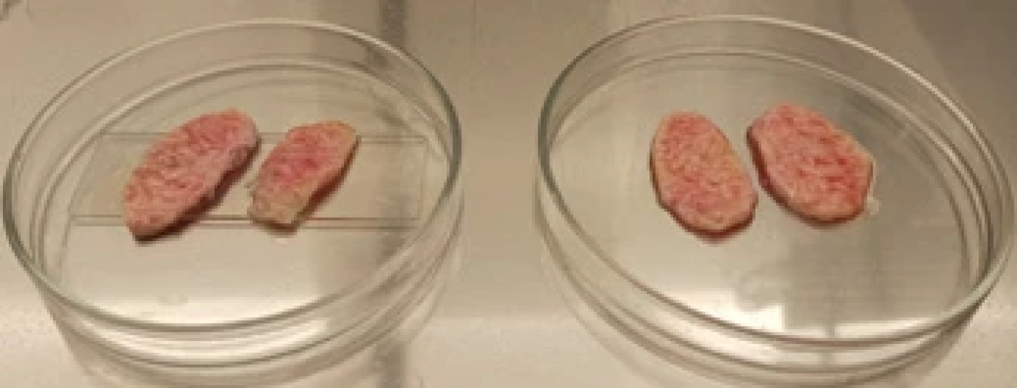 Příprava tenkého plátu kortexu po odstranění tukové a medulární části. Fig. 3. Preparation of a thin cortex slice after removal of the fatty and medullary parts.