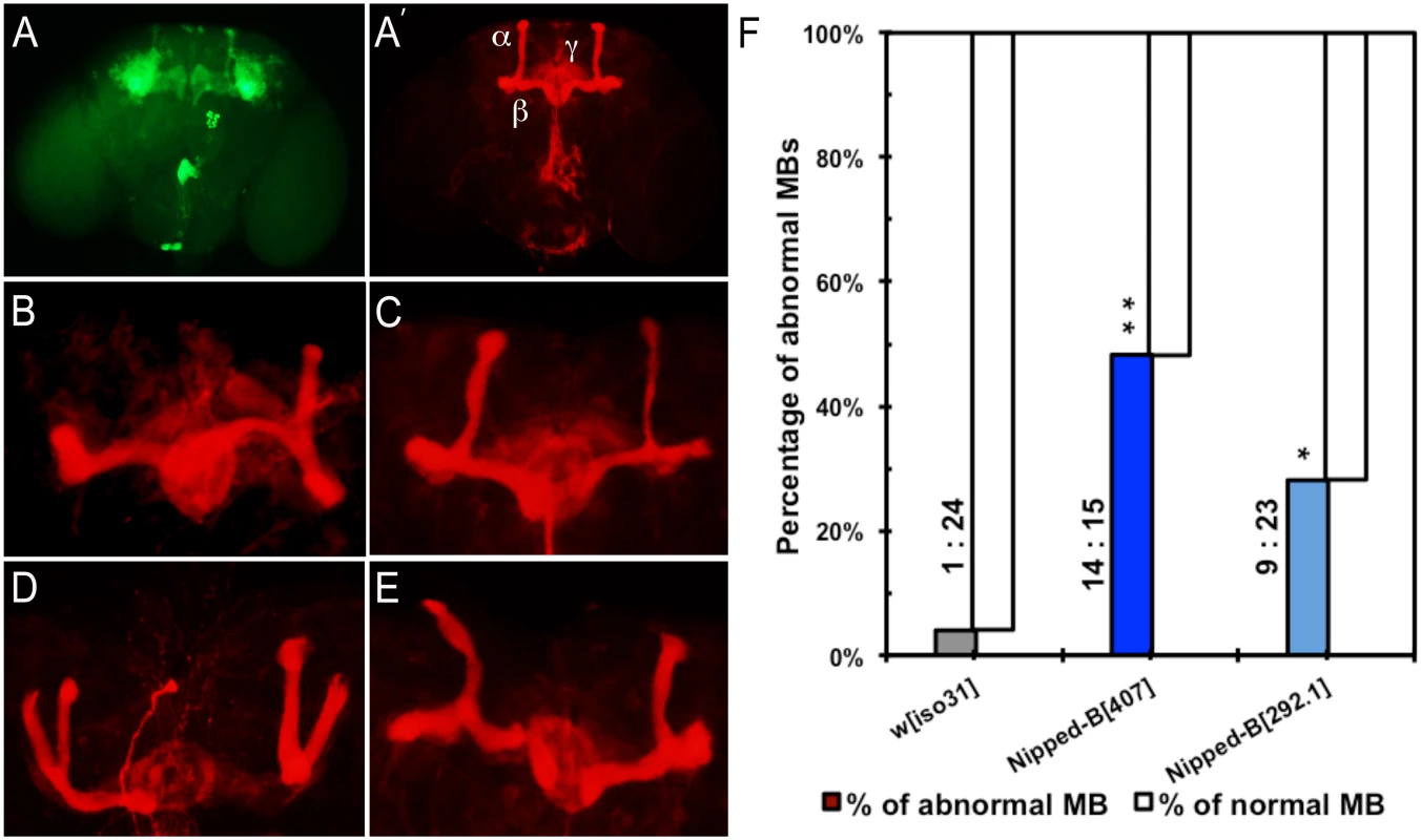 Mushroom body abnormalities seen in <i>Nipped-B</i> heterozygotes.