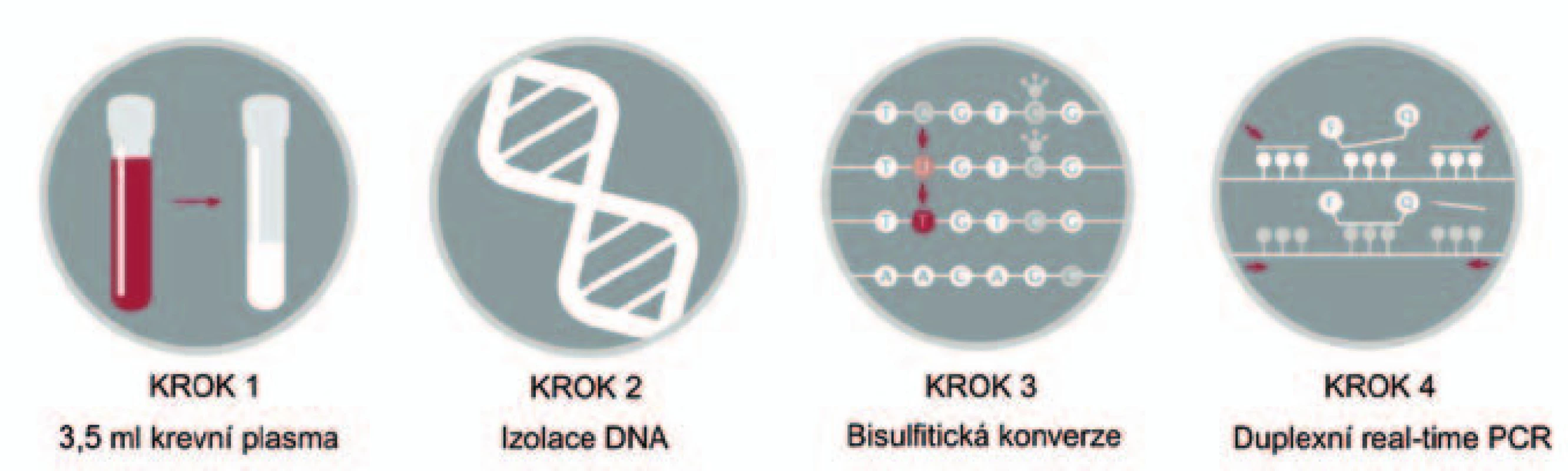Schematické znázornění laboratorních kroků u vyšetření SEPT9.