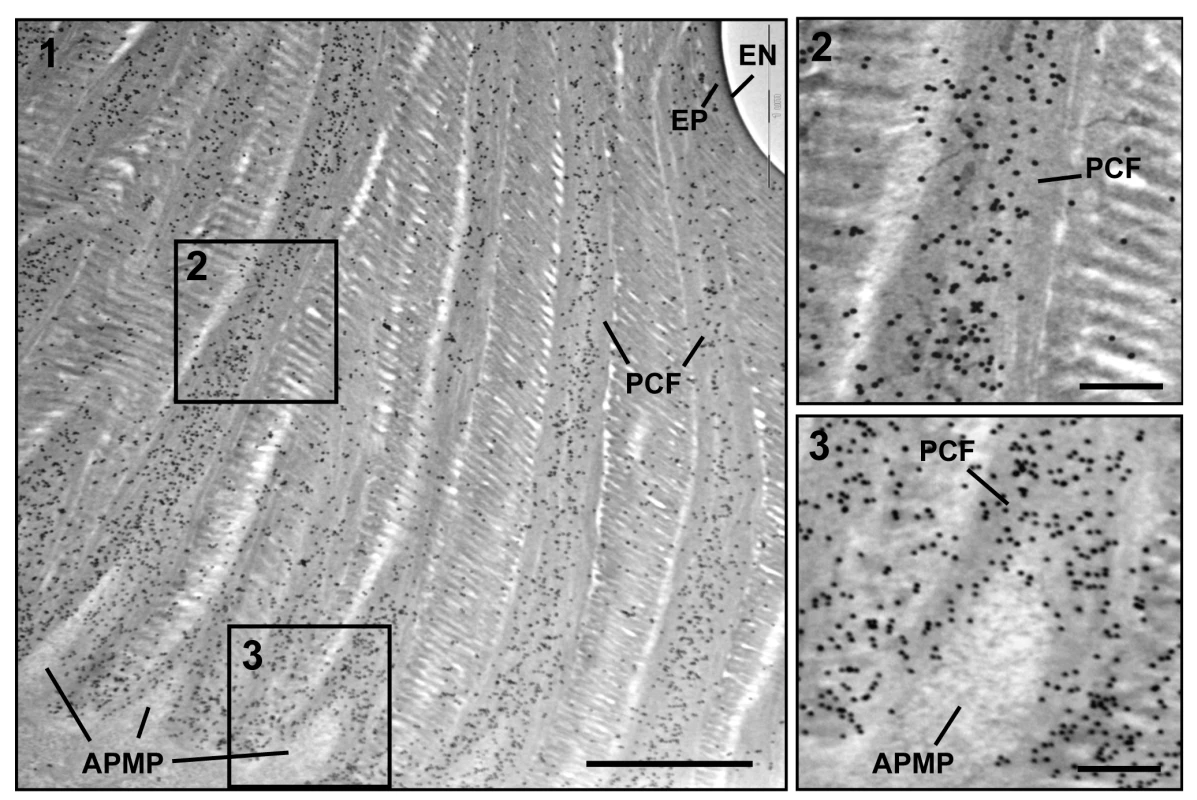 Immunogold labeling followed by TEM analysis for TcCPR4.
