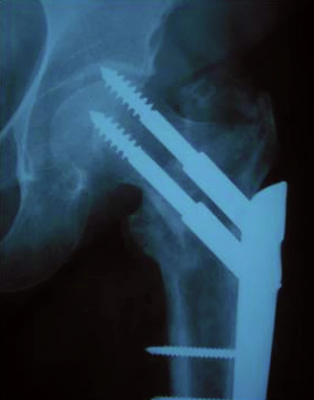Cut out fenomén