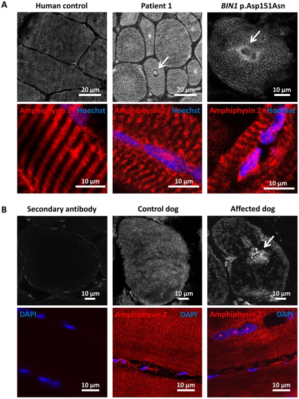Amphiphysin 2 is present but altered in muscles from affected humans and dogs.