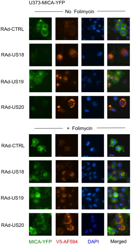Degradation of MICA-YFP by US18 and US20 in U373 cells.