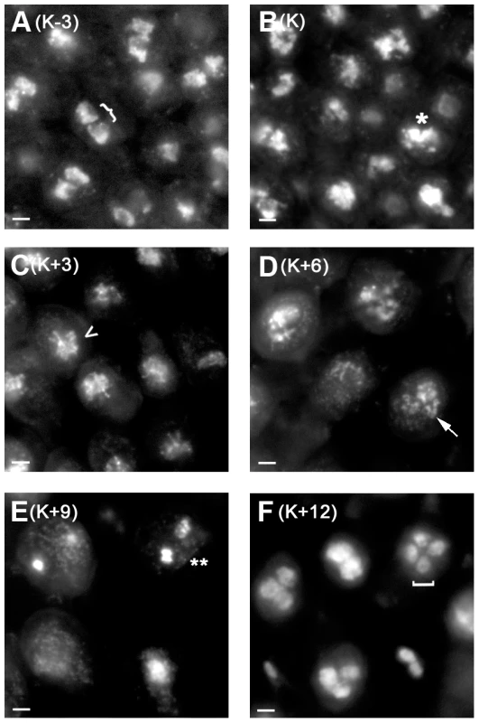 <i>C. cinerea</i> nuclei during meiosis.