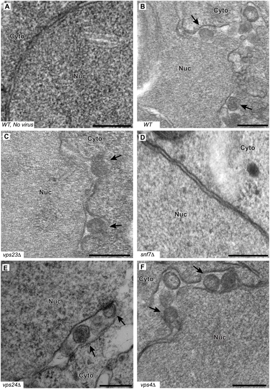 BMV spherule formation is abolished in the absence of Snf7p.