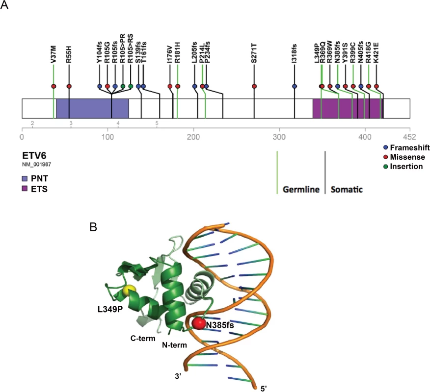 Location of somatic and germline <i>ETV6</i> mutations and structural modeling.