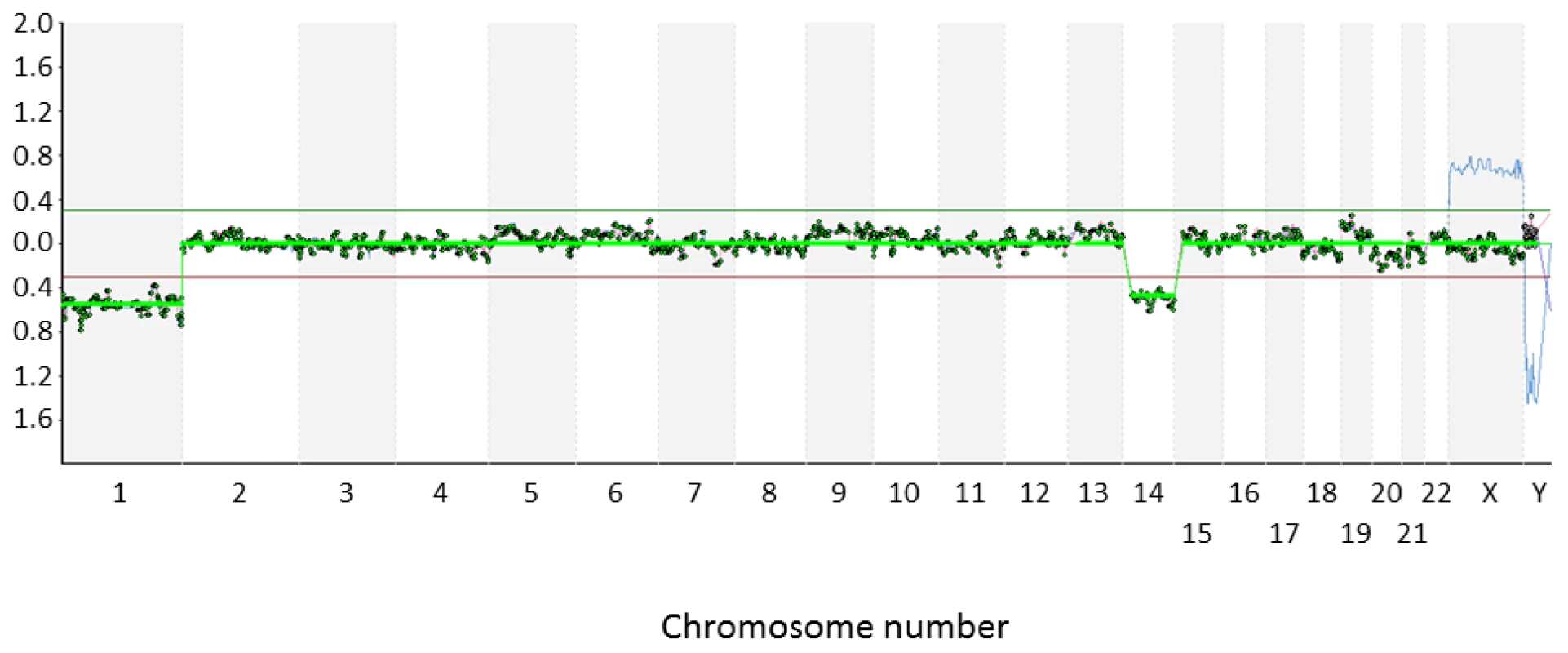 Microarray-CGH analysis of an embryo from a Robertsonian translocation carrier.