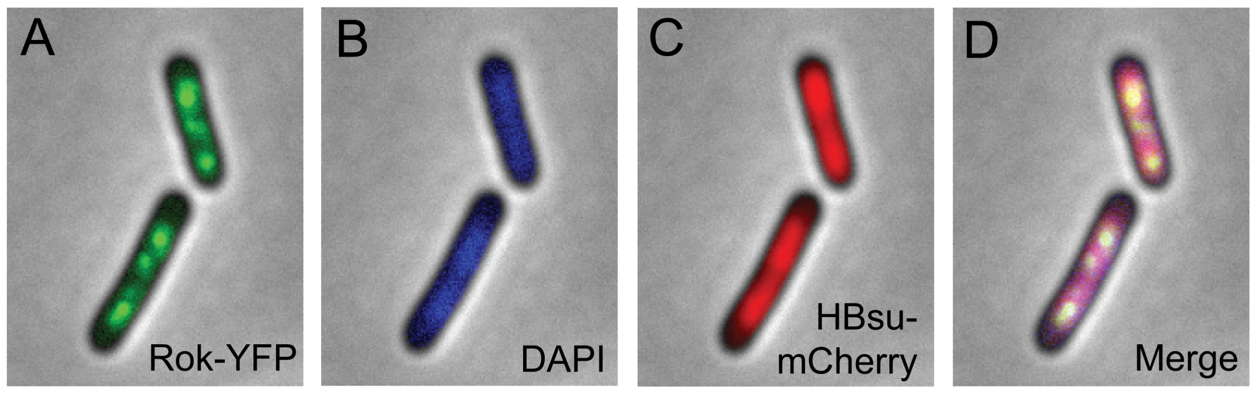 Localization of fluorescent Rok and HBsu fusion proteins.