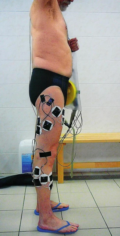 Aplikace elektrod – pohled z boku.