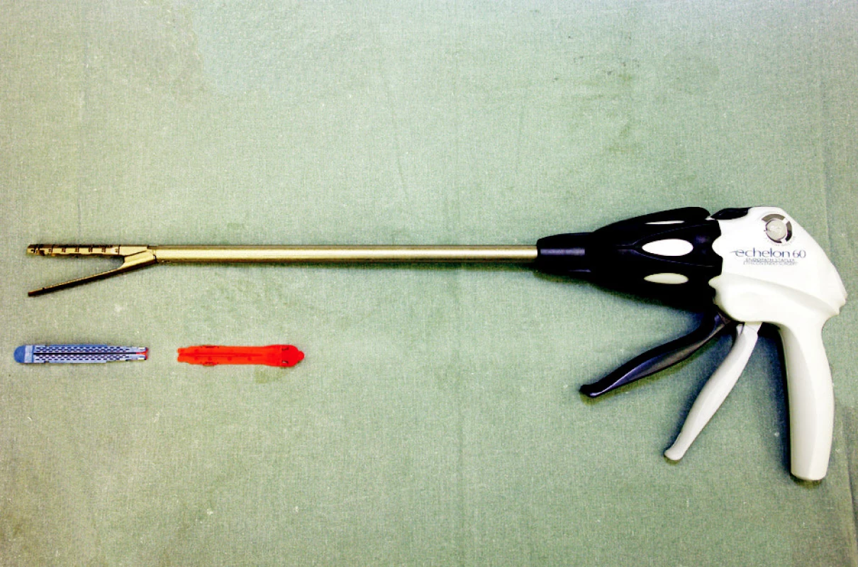 Resekční endostapler 60 mm
Fig. 3. Resection endostapler 60 mm