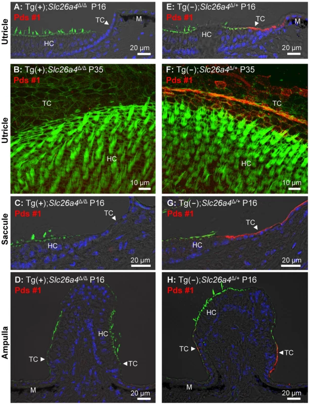 Histology and pendrin expression in the vestibular labyrinth.