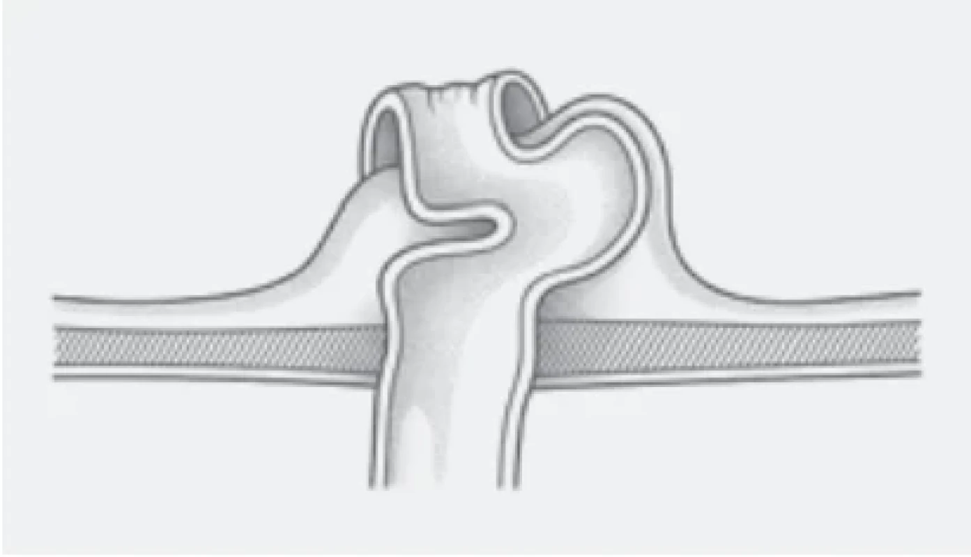  / Fig. 3.