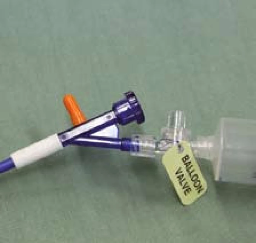 Proximální konec zavaděče připravený k insuflaci. Oranžová tlaková chlopeň na zavaděči v normální pozici.
Fig. 7. Proximal end of the applicator prepared for insufflation. Orange pressure valve in the applicator in the normal position.