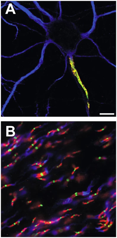 Ion channels are clustered in mammalian axons at the AIS and nodes of Ranvier.