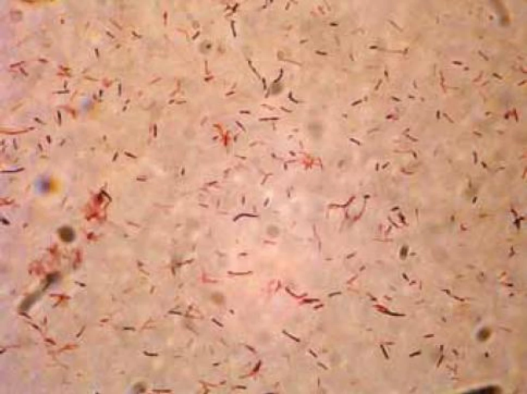 Kmen 17A Lactobacillus acidophilus/crispatus.