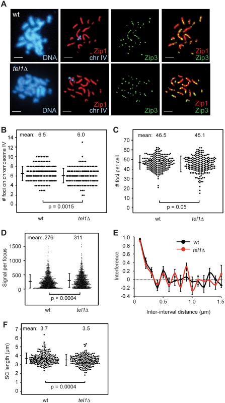 SIC abundance and interference in <i>tel1Δ</i> are similar to wild type.