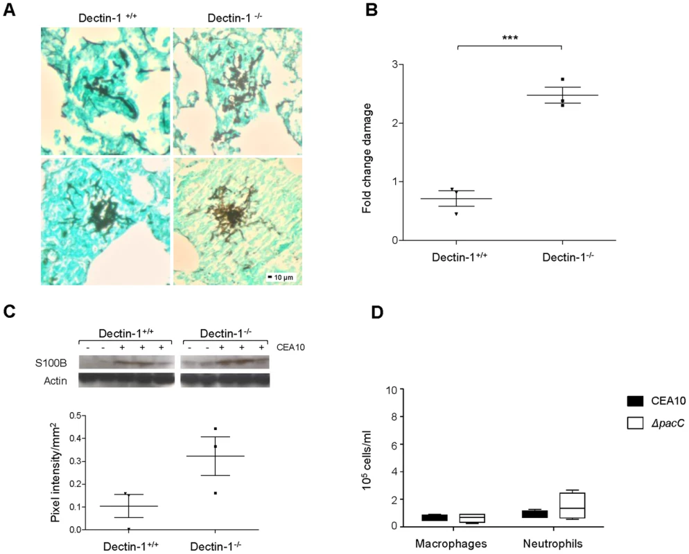 Internalisation and Dectin-1 protect murine pulmonary epithelia from <i>A. fumigatus</i>-mediated damage.