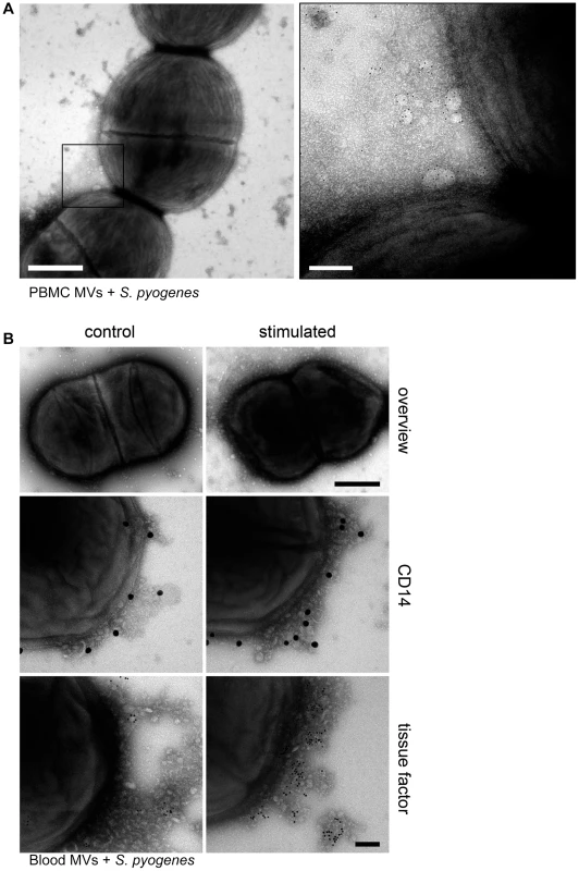 MVs bind to <i>S.</i> <i>pyogenes</i>.